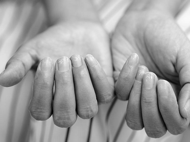 Why does washing dishes make your fingernails grow? image 4