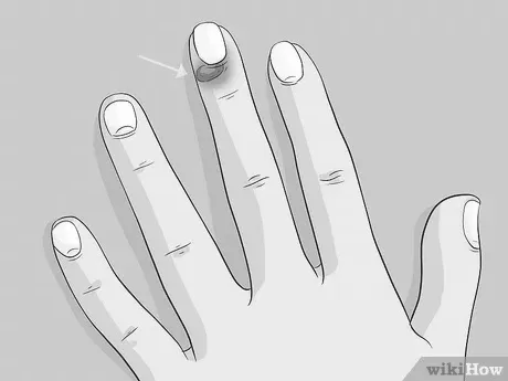 Why does washing dishes make your fingernails grow? image 9