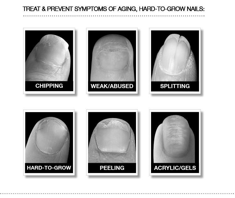 How do acrylic nails harm natural nails? image 11