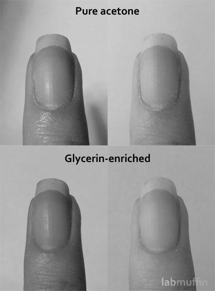 How does acetone damage your nails? image 9