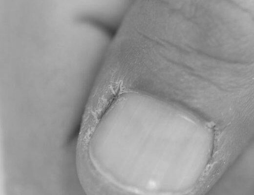 Is soaking fingers in acetone dangerous? photo 0