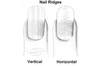 Is it possible to reverse vertical nail ridges? photo 0