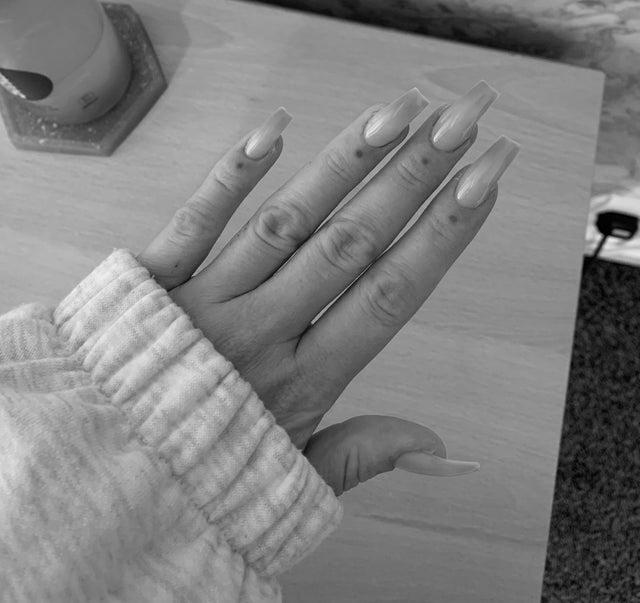 Why are the tips of my nails orange? photo 13