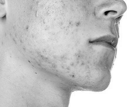 How bad should your skin be before you see a dermatologist? photo 1