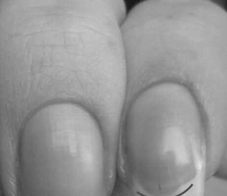 How to make my nail beds shorter? photo 0