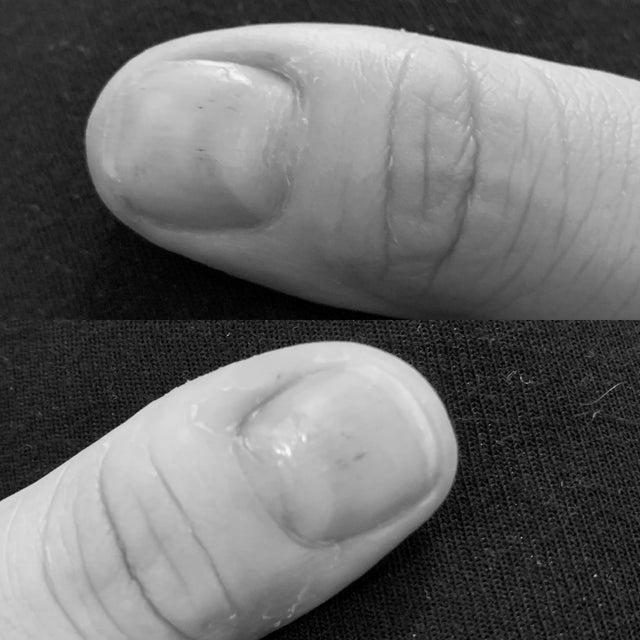 How can I get the lunulae back to my fingers? image 2