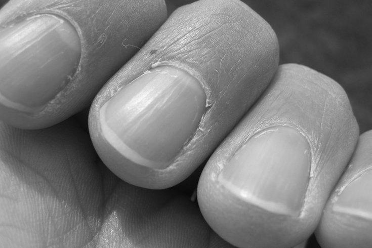 Why are fingernails hard? photo 7
