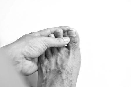 What are the major causes of ingrown toenails? photo 15