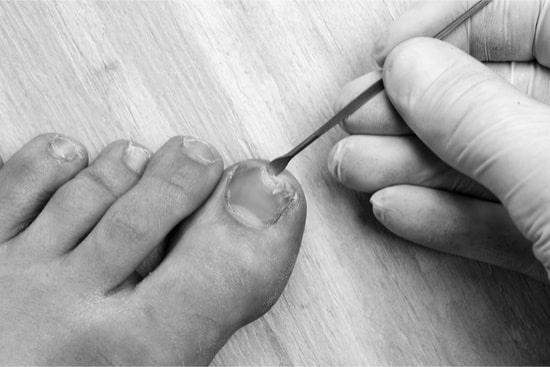 How can you treat smelly toenails? photo 1