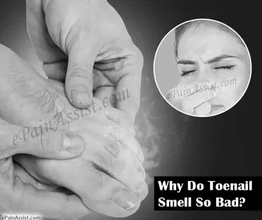 How can you treat smelly toenails? photo 3