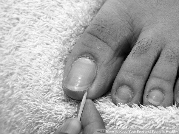 How can you treat smelly toenails? photo 6