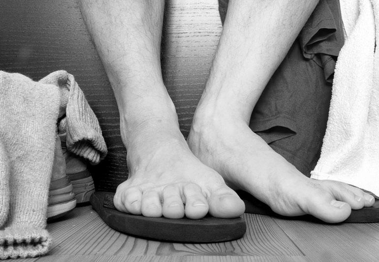 How can you treat smelly toenails? photo 7