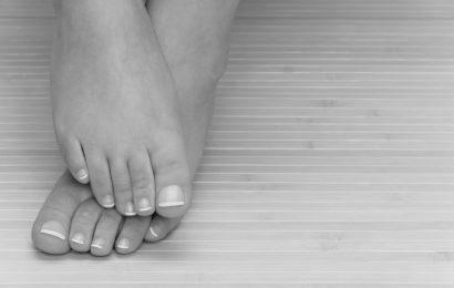 How are toenail fungus and type 2 diabetes related? image 8