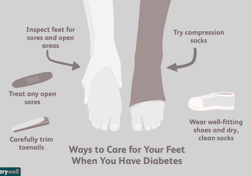 How are toenail fungus and type 2 diabetes related? image 15