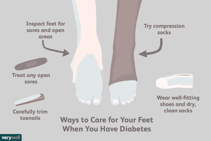How are toenail fungus and type 2 diabetes related? image 17