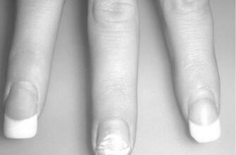 Are acrylic nail fumes dangerous? image 0
