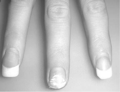 Are acrylic nail fumes dangerous? image 0