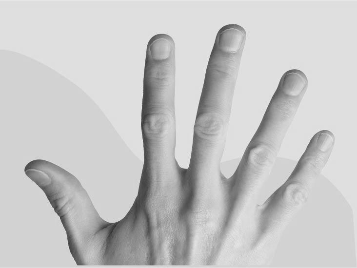What do split fingernails indicate? image 15