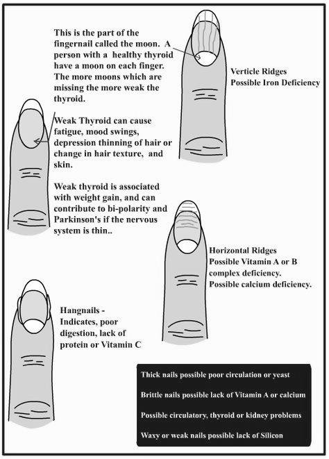 What do split fingernails indicate? image 16