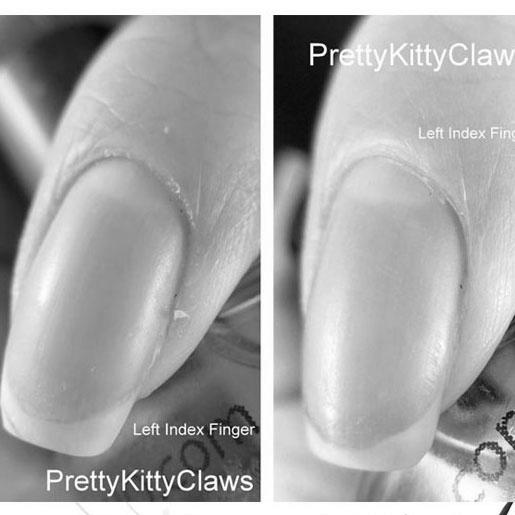 How to take care of brittle nails? photo 11