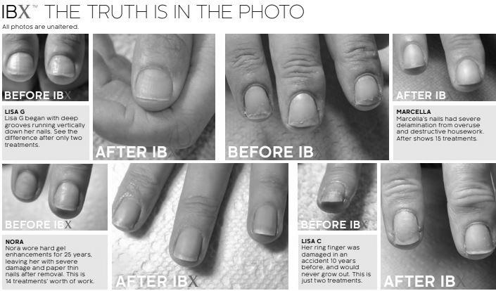 How can I treat paper thin fingernails? photo 2