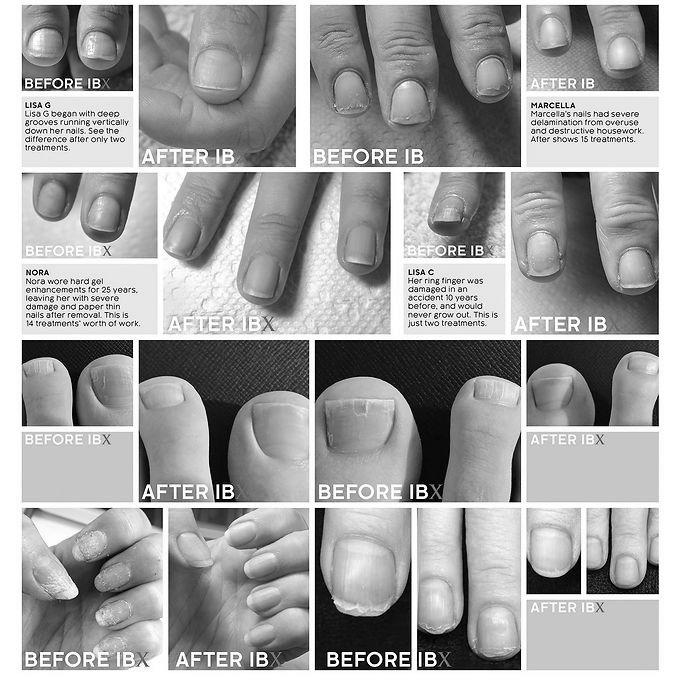 How can I treat paper thin fingernails? photo 11