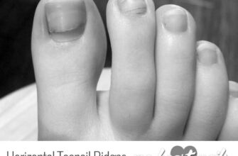 Why do some toenails have horizontal ridges? image 0
