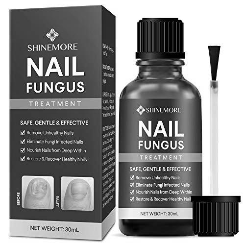 What is the best solution/remedy for exposed nail bed fungus? photo 15