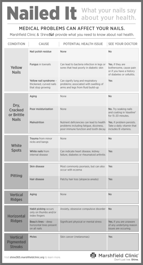 What do horizontal ridges on your fingernails mean? image 7