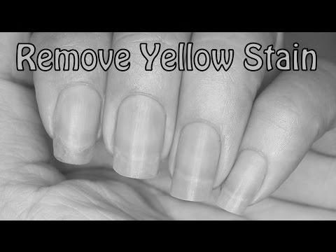 Why do you get yellow nails and how do you get rid of it? photo 4