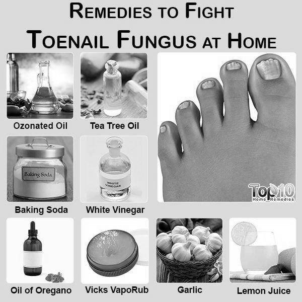 Does Vicks Vaporub really cure toenail fungus? photo 9
