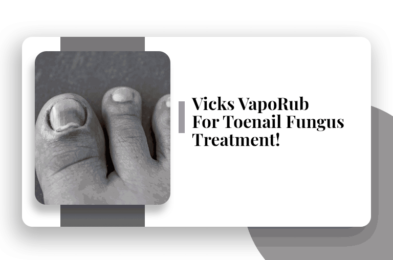 Does Vicks Vaporub really cure toenail fungus? photo 15