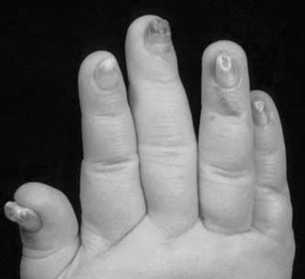 Why should we study nail disorders and diseases? image 11