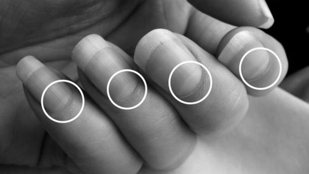 What are the little half moons in our nails? image 9