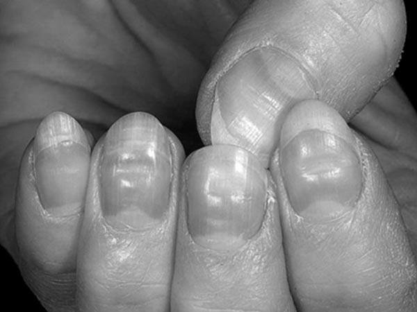 What are the little half moons in our nails? image 18