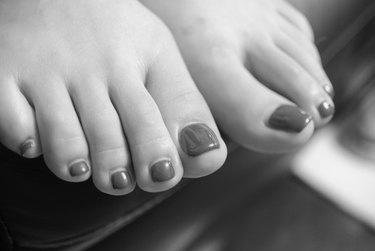 Why does the underside of toenails smell bad? image 13
