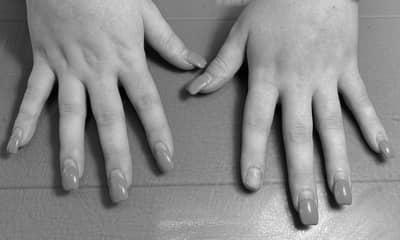 Do acrylic nails get longer when you keep getting refills? image 1