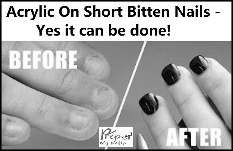 Can you get a gel manicure with very short nails? photo 3