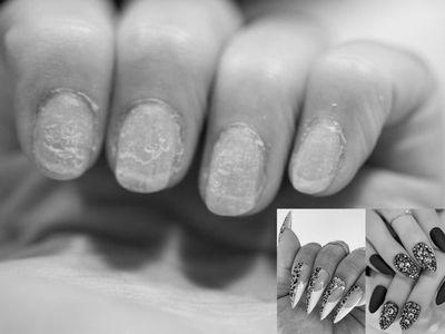 How much damage do acrylics really do to your nails? image 1