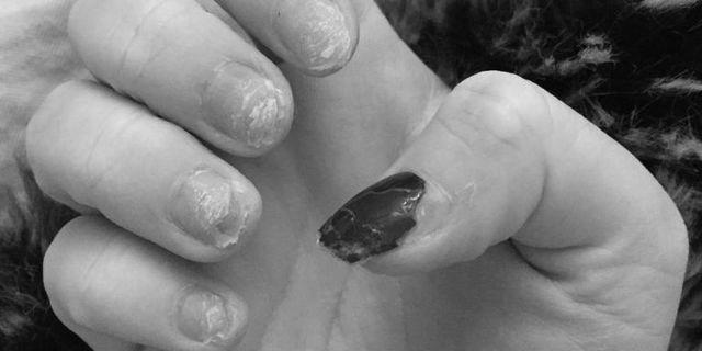 How much damage do acrylics really do to your nails? image 8