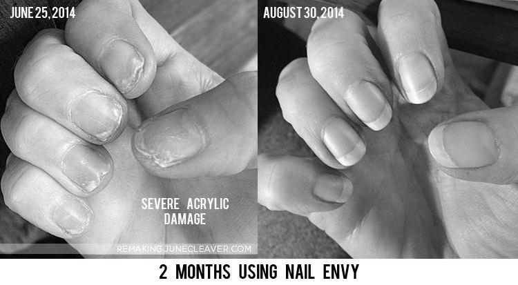 How much damage do acrylics really do to your nails? image 15