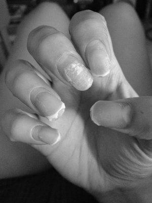 Can you use hot water to remove acrylic nails? image 15